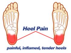 Plantar Fascitis, Problem Skin, Mobility Exercises, Ginger Root, Foot Health, Diy Health, Top Five