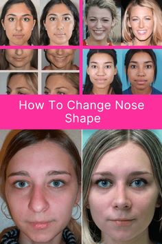 How to Change Your Nose Shape, change nose shape, crooked nose, straighten nose bridge, straighten nose, perfect nose shape Perfect Nose Shape, Nose Straightener, The Perfect Nose, Crooked Nose, Perfect Nose, Celebrity Plastic Surgery, Nose Shapes, Under The Knife, School Study Tips