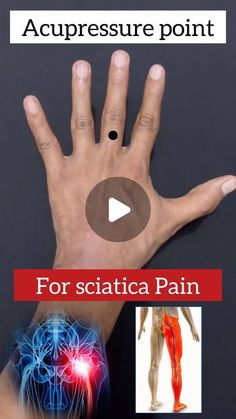 Acupressure Point, Tai Chi Exercise, Sciatic Nerve Pain, Sciatica Pain, Sciatic Nerve, Acupressure Points, Nerve Pain, Sciatica, Acupressure