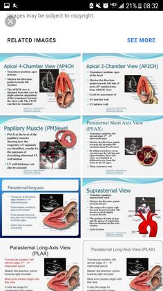 an image of medical diagrams on the screen