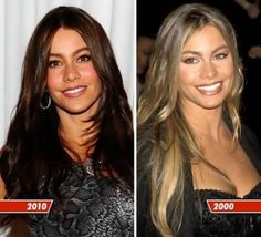 before and after photos of the same woman's plastic surgery, from 2009 to 2010