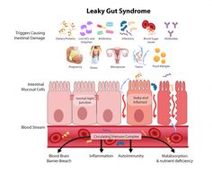 Heal Leaky Gut, Nutrient Deficiency, Gut Healing, Leaky Gut, Functional Medicine, Acid Reflux, Fitness Blog, Digestive System