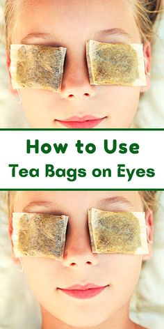 Chamomile Eye Compress, Chamomile Tea Bags For Eyes, Remedies For Stye On Eyelid, Puff Eyes Remedies, Tea Bags On Eyes, Tea Bags For Eyes, Swollen Eyelids Remedy, Tired Eyes Remedy, Teabags For Eyes