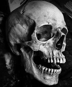 a black and white photo of a human skull