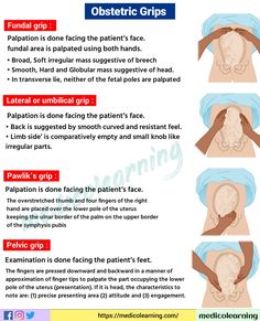 the procedure is shown with instructions for how to use an obstetric grips