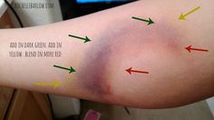 Stages Of Bruising, Halloween Makeup Fake Wounds, Fx Makeup Wounds, Halloween Makeup Bruising, Makeup Bruising, Sfx Bruising, Gore Sfx Makeup, Halloween Wound Makeup, Fake Bruising