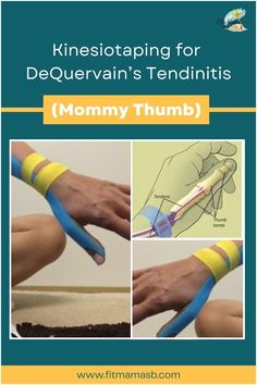 Discover the power of Kinesio taping in relieving DeQuervain's tendinitis, commonly known as "Mommy Thumb." Learn about effective taping techniques, exercises, and self-care tips to alleviate pain, improve mobility, and support your postpartum journey. Visit our website for expert guidance on tackling Mommy Thumb. Kt Tape Elbow Pain, Kt Tape Carpal Tunnel, Kt Tape Thumb, Physio Tape