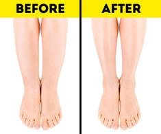 before and after pictures of a woman's legs