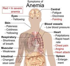 Are you Anemic? Signs to Look Out for Low Blood Pressure, Med Student, Chest Pain, Chronic Fatigue, Detox Smoothie