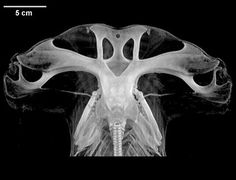 an x - ray shows the bones of a human head