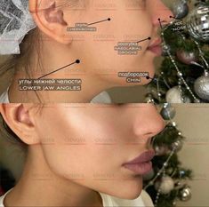 Botox For Nose Tip, Full Face Fillers Before And After, Botox And Fillers Before After, Nose Botox Before And After, Face Balancing Fillers, Cheek Fillers Before And After Face