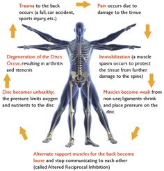 Sports Injury, Chronic Pain, Back Pain