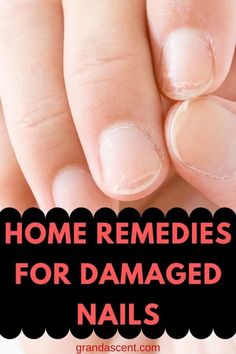 Broken Nails, Damaged Nails, Home Tips, Nail Health, Healthy Nails, Winter Nails, Fashion Tees, Home Remedies