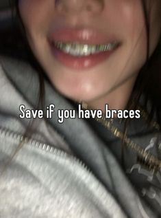 my #whisper #save #braces Life With Braces, How To Stop Braces Pain, Fall Braces Colors, How To Look Good With Braces, Braces Whisper, Getting Braces Off, Orange Braces, Light Blue Braces, People With Braces