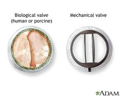 two different types of food are shown in this graphic above the words mechanical valve, mechanical valve human or porine