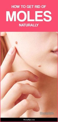 This Homemade Gel Can Remove Wrinkles Moles On Face, Garnier Skin Care, Remove Skin Tags Naturally, Mole Removal, Cold Sores Remedies, Natural Sleep Remedies, Natural Cough Remedies, Lose 40 Pounds