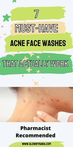 Looking for an acne face wash that actually works? Check this pharmacist Guide on the best acne face wash acne face wash, acne face wash best, acne face wash for sensitive skin, face wash for acne prone skin, face wash for acne, face wash for acne and oily skin, cleanser for acne, acne skincare routine, how to treat acne at home, salicylic acid cleanser, face wash for cystic acne, Best Acne Face Wash, Clear Acne Fast, Face Wash For Sensitive Skin, Oily Skin Cleanser, Face Wash For Acne, Cleanser For Acne, Sensitive Skin Face Wash, Clear Your Skin, Salicylic Acid Cleanser