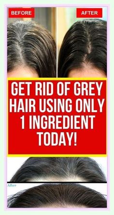 Grey Hair Remedies, Healthy Recipes For Picky Eaters, Exercise Challenges, Lemon Hair, Easy Recipes For Beginners, Ditch The Carbs, Hair Remedies, Get Happy, Healthy Family