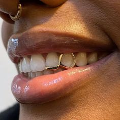 a close up of a person's mouth with gold rings on it and teeth