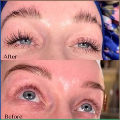 Incredible results from using our #lash and #brow enhancing serum! #eyelash #lashgrowth #eyebrow #browgrowth #longlashes Eyebrows Serum, Good Eyebrows, Overplucked Eyebrows, Brow Transformation, Lash And Brow Serum, Eyebrow Trends, Lash Growth Serum, Eyebrow Hacks, Eyebrow Serum