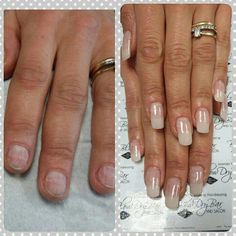 Green Nail Syndrome, Gel Overlay Nails, Nails After Acrylics, Natural Acrylic, Natural Looking Nails, Overlay Nails, Gel French Manicure, Nail Goals