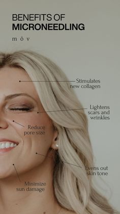 A picture of a women smiling with labels of benefits of microneedling Microneedling Benefits, Forehead Acne, Skin Needling, Lighten Scars, Skin Aesthetics, Facial Aesthetics, Aesthetic Clinic, Boulder Co