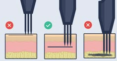 three different stages of hair growth