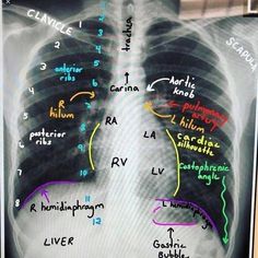 an x - ray shows the location of the lungs and their major functions in each region