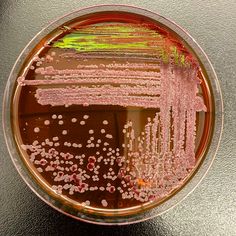 a glass plate with some pink and green things in it on a black table top