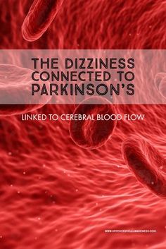 The Dizziness Connected to Parkinson’s, Linked to Cerebral Blood Flow Dizziness Causes, Forward Head Posture Exercises, Sciatic Nerve Pain, Nerve Pain, One Month, Blood Flow, The Brain