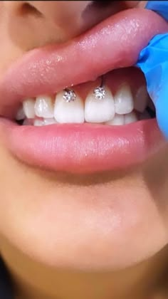 a woman is getting her teeth brushed by a dentist in blue gloves and rubber gloves