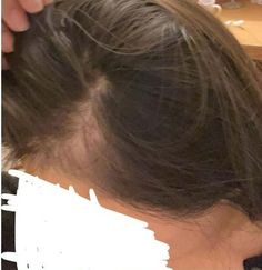 SHE was desperately hunting for solutions after her hair began falling out. But one woman has explained it was actually after finding a £20 product she now swears by, that things began to change for her. She took to Reddit to explain that she had only saved a few pictures of her “hair journey”, as […]