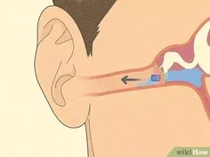 The Eustachian tubes are small passages in the head that connect the ears to the back of the nostrils. These tubes can become clogged due to colds and allergies. Serious cases need expert medical attention from an ear, nose, and throat... Inner Ear, Allergies, Medical