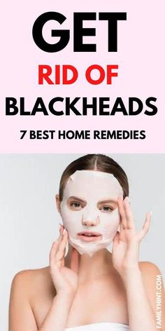 Remedy For Blackheads, Nose Blackheads, Blackhead Remedies, To Remove Blackheads, Blackheads On Nose, Skincare Acne, Skin Natural Remedies