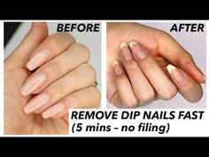 HOW TO REMOVE DIP NAILS FAST (5 mins – no filing needed!) - YouTube Dip Powder Pedicure Ideas, How To Get Dipped Nails Off At Home, How To Remove Tips Nails At Home, Remove Sns Nails At Home, Diy Sns Nails At Home, Nail Removal