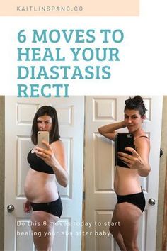 Do these 6 exercise moves to start healing your Diastasis RectiThese moves will help to rebuild your core after pregnancy. Post Pregnancy Workout, Insanity Workout, Baby Workout, Mommy Workout, Postnatal Workout