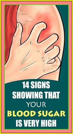 14 Signs Showing That Your Blood Sugar Is Very High Blood Sugar Symptoms, Body Cells, Sugar Level, High Blood Sugar, Blood Sugar Levels, Blood Sugar, Apple Cider, Natural Remedies, Cider