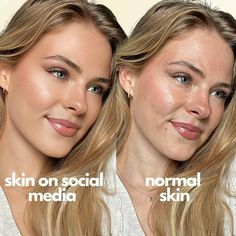 Filter Is Not Real Life Face Mapping Acne, Eyeliner Techniques, Real Skin, Celebrity Skin, Clear Face, Swag Girl Style, Healthy Skin Tips, Face Acne, Perfect Relationship