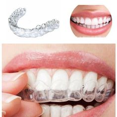 Item Description： Features: 1. High-quality material: This brace is made of silicone and silicone, which retains its softness and gives it a certain thermoplasticity. It can be effectively shaped by soaking in water at about 80 degrees Celsius, and it can be quickly shaped after cooling. The material currently used in many professional braces. 2. Good shape stability: Compared with ordinary braces, it can be soaked in boiling water for a long time, and it will not deform or shrink so badly that Braces Retainer, Retainer Teeth, Teeth Clenching, Night Guard, Teeth Braces, Teeth Whitening Strips, Yellow Teeth, Grinding Teeth, Receding Gums