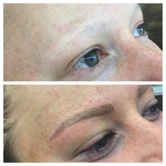 It's not all about vanity. So happy to be able to give this client eyebrows through Brow Embroidery Microblading, So Happy, Eyebrows, Vanity