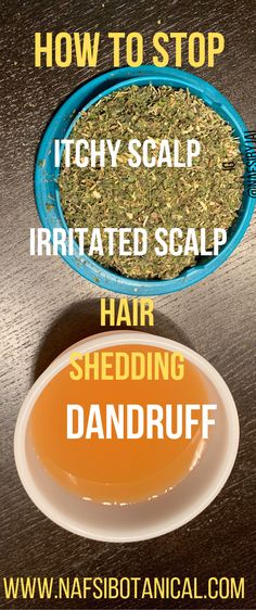 Natural Hair Scalp Care, Scaly Scalp Remedies, Oily Scalp Remedy Diy, Scalp Scrub Diy Dandruff Remedy, Diy Dry Scalp Remedy, Herbs For Dry Scalp, Sore Scalp Remedies, Hair Mask For Itchy Scalp Diy, Extreme Dandruff Remedies