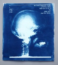 an x - ray image of a human skull