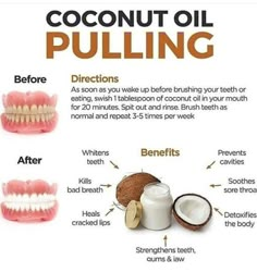 Oil Pulling Benefits, Remedies For Tooth Ache, Coconut Oil For Teeth, Whiter Teeth, Benefits Of Coconut, Food Health Benefits, Coconut Oil Pulling, Teeth Health, Benefits Of Coconut Oil