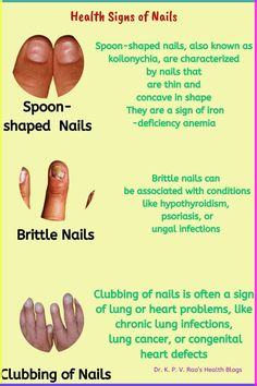 Your nails are not just a fashion statement; they serve as a window into your overall health. Variou Sugar Withdrawal Symptoms, Signs Of Iron Deficiency, Lung Health, Health Blogs, Congenital Heart Defect, February Nails, Gel Acrylic Nails