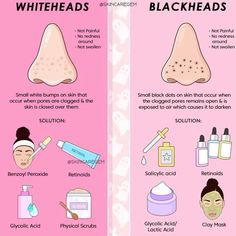 Remove Whiteheads, Haut Routine, Blackheads On Nose, Skin Advice, Basic Skin Care Routine, Perfect Skin Care Routine, Get Rid Of Blackheads, Skin Routine