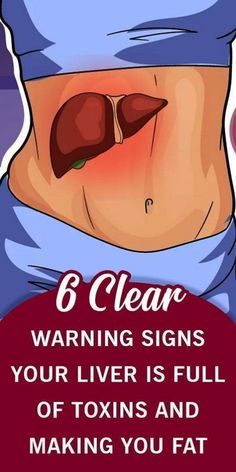 Signs Of Liver Damage, Women Lips, Health Meals, Liver Damage, Healthy Woman, Health Women, Natural Health Supplements, Health Bar, Health Topics