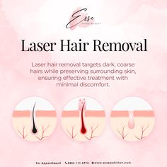 Did you know? Laser hair removal offers precise targeting, eliminating unwanted hair while leaving your skin smooth and undamaged. Bid farewell to stubborn hair with minimal discomfort! #beauty #laser #skincare Hair Removal Ads, Beauty Laser, Unwanted Hair, Smooth Skin, Your Skin