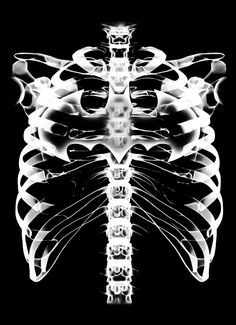 an x - ray image of a skeleton in black and white, showing the ribs