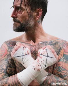 a man with tattoos and bandages on his hands