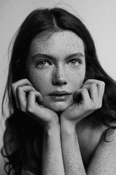 a black and white photo of a woman with freckles on her face, looking at the camera